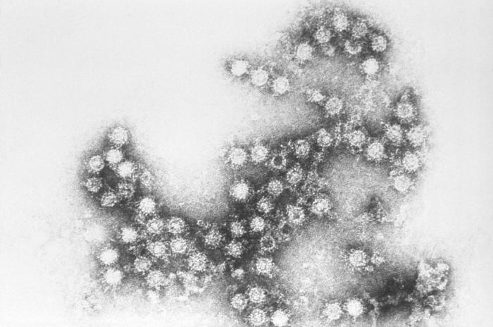 A non-polio enterovirus as seen under a microscope