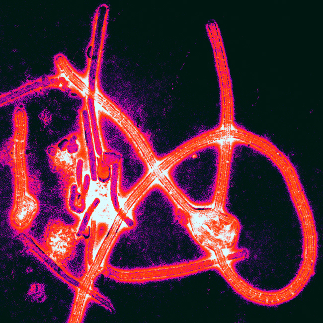 Thomas W. Geisbert, Boston University School of Medicine - PLoS Pathogens, November 2008 direct link to the image description page doi:10.1371/journal.ppat.1000225
Color-enhanced electron micrograph of Ebola virus particles.
