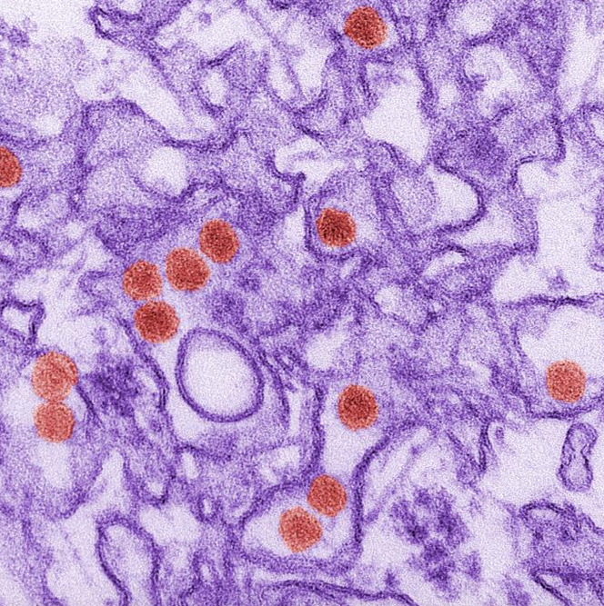 CDC says serious illness from Zika virus is uncommon.